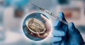 Vacuna chilena con proteína del loco muestra avances contra el cáncer a la piel