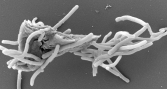 La tenacibaculosis activa distintas defensas según el tejido del salmón Atlántico
